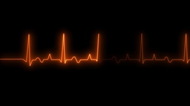 Glowing Neon Heartbeat ECG Line Animation Isolated on Black Background, Pink and Blue Electric Heart Rate Pulse Waveform for Medical, Health and Science Concept Motion Graphic.