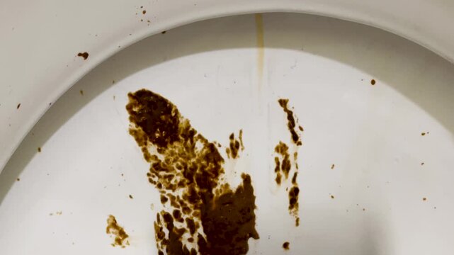 Dirty toilet, human feces on the toilet