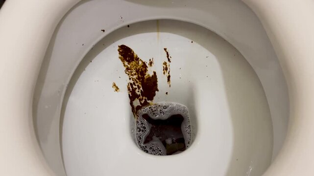 Dirty toilet, human feces on the toilet