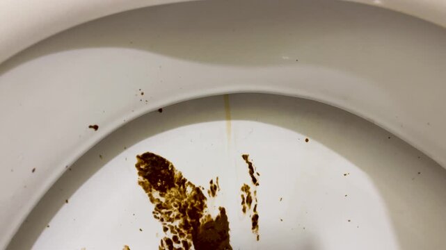 Dirty toilet, human feces on the toilet
