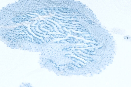 a high-angle macro shot displays a light blue textured surface, which appears to be bubble wrap or protective foam film covered with a frosty layer of ice or condensation pattern