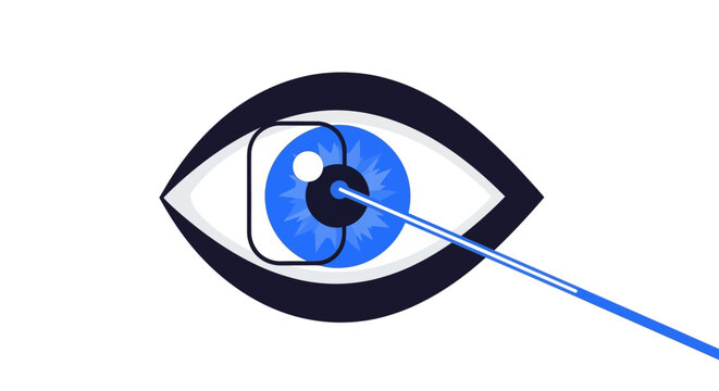 Laser Eye Surgery and Vision Correction Vector Illustration - Ophthalmology, LASIK Treatment, Biometric Scanning, and Optometry Concept Icon