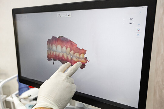 Dentist pointing at 3D dental model on computer screen in modern clinic