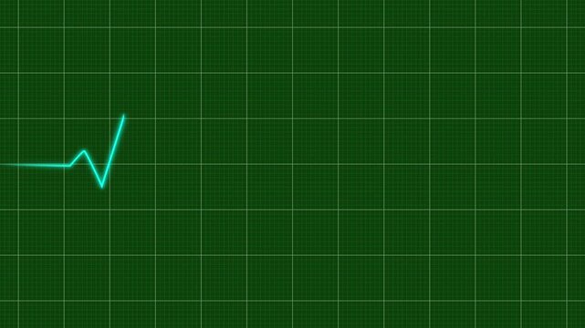 A pulsing green ecg line on a medical heart monitor screen, seamlessly loop animation, green line graph of heart rhythm on medical screen with grid, healthcare and technology concept, 4