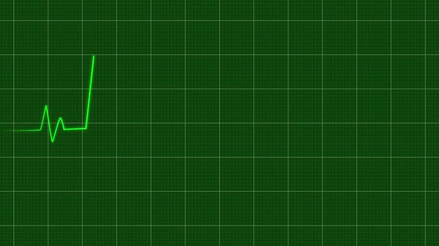 A pulsing green ecg line on a medical heart monitor screen, seamlessly loop animation, green line graph of heart rhythm on medical screen with grid, healthcare and technology concept, 4