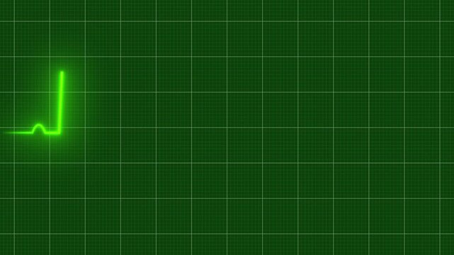 A pulsing green ecg line on a medical heart monitor screen, seamlessly loop animation, green line graph of heart rhythm on medical screen with grid, healthcare and technology concept, 4