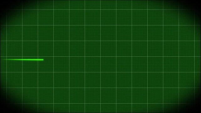 A pulsing green ecg line on a medical heart monitor screen, seamlessly loop animation, green line graph of heart rhythm on medical screen with grid, healthcare and technology concept, 4