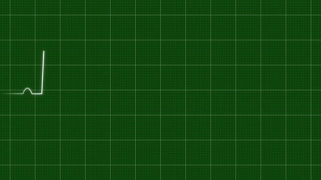 Heart rate monitor electrocardiogram Ekg Or Ecg, white heart beat line animation on green background, loop seamlessly heartbeat in a stressful situation, symbolizing heart activity, 4k