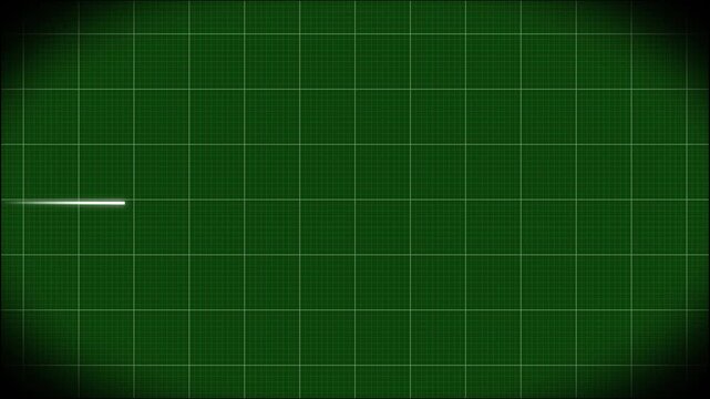 Heart rate monitor electrocardiogram Ekg Or Ecg, white heart beat line animation on green background, loop seamlessly heartbeat in a stressful situation, symbolizing heart activity, 4k