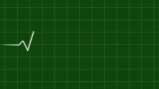 Heart rate monitor electrocardiogram Ekg Or Ecg, white heart beat line animation on green background, loop seamlessly heartbeat in a stressful situation, symbolizing heart activity, 4k
