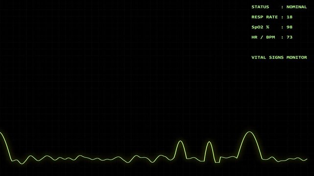 scientific math | Ekg vital monitor with medical status data for healthcare publications, medical blogs, science websites, hospital presentations, and health reports. Alpha channel.
