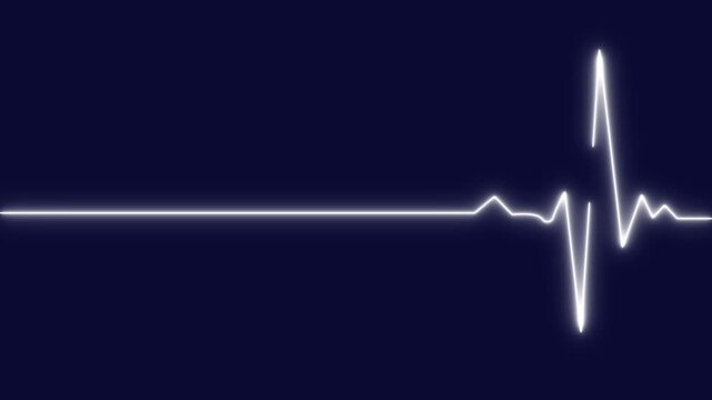 EKG Heart Line, Glowing neon green Heartbeat pulse line rate graph. Electrocardiogram show heart beat line. cardiogram, Heart pulse. Motion graphics of neon EKG line