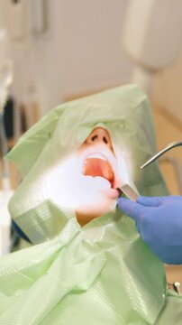 Dentist using surgical pliers to remove a decaying tooth in stomatology room