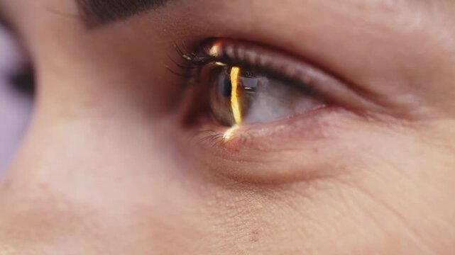Close-up of a human eye illuminated by a narrow beam of light from a slit lamp, showcasing the intricate details of the iris and pupil in a clinical setting