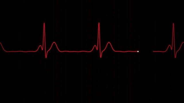 Heartbeat flatline medical monitor screen