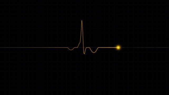 Heartbeat flatline motion graphic monitor