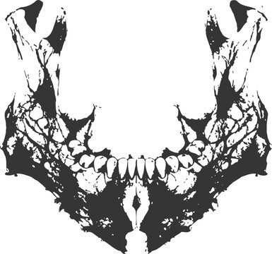 A structured rorschach style inkblot forming a hinged jawbone with teeth. Medical diagnostic concept.
