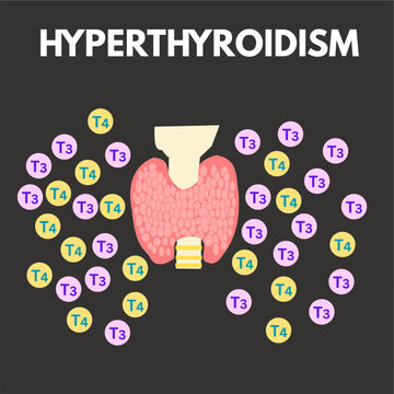 hyperthyroidism condition of thyroid gland secreting more t3 and t4 hormones.eps