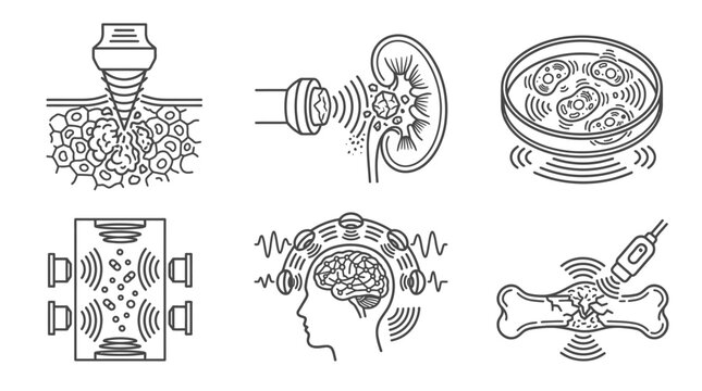 Medical Ultrasound Therapy Icons: Kidney, Brain, Bone, Cells