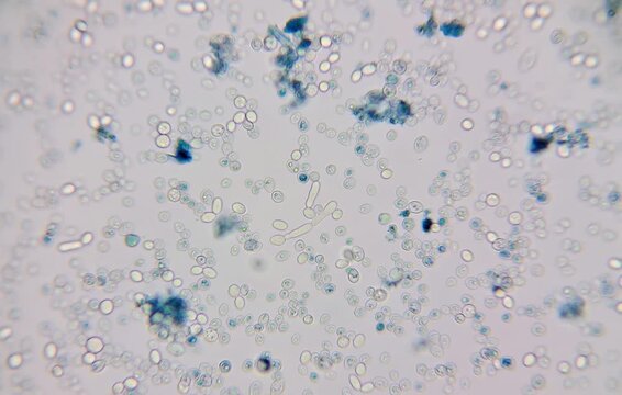 craft beer under the microscope