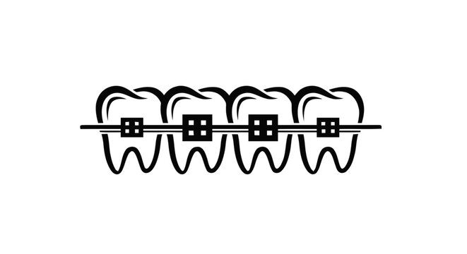 Vector illustration of vector illustration of teeth with dental braces on a transparent background