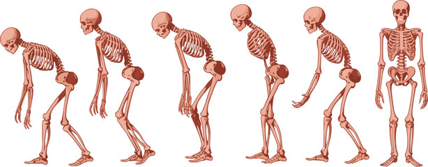 Detailed medical illustration showing human skeletal evolution from a hunched gait to a healthy upright posture on white. ©  Victory Pixel