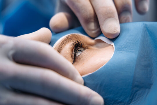 Patient's eye being carefully exposed during microsurgery with gloved hands holding a surgical drape in a sterile medical environment