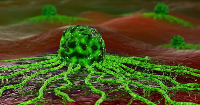 Cancer Cell Growth Inside Human Tissue Showing Tumor Expansion, Angiogenesis, Metastatic Invasion, Cellular Networking, Immune Evasion, and Oncology Healthcare Research 3D Rendering
