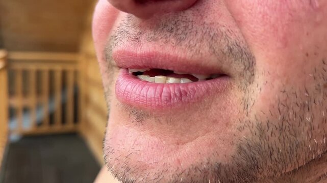 Macro video of a Caucasian male smiling and showing a missing upper central incisor. Concept of dental trauma, tooth loss, and dental care.