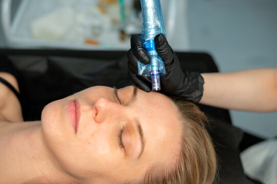 Cosmetologist holds a microneedling device with a sterile disposable needle cartridge before treatment. Concept of aesthetic medicine, professional skincare and skin rejuvenation.