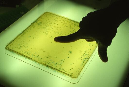 Pointing out bacterial colony on agar plate.