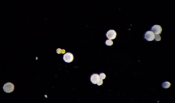 Pollen under the microscope
