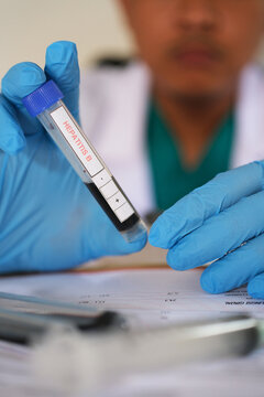 Hand holding a blood sample with HEPATITIS B written on it. Blood sample tube for analysis and testing of the hepatitis B virus.