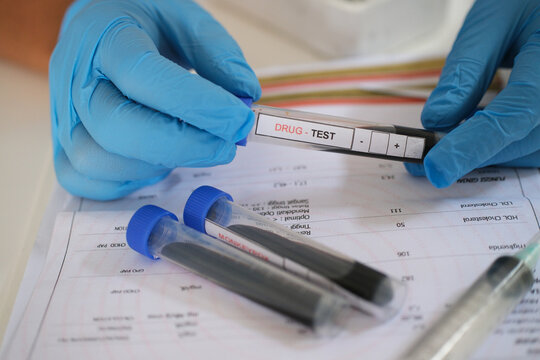Hand holding a glass test tube containing a patient's blood sample for drug testing.