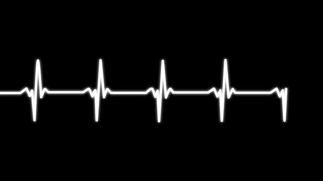 Heartbeat line. Pulse line. Cardiogram ecg. Medical monitoring. alpha channel