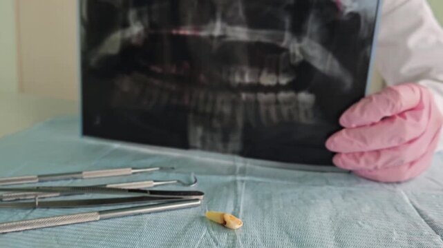 Dental examination shows x-ray results and tools used to prepare for a procedure