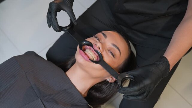 Dentist inserting lip retractor before teeth whitening procedure