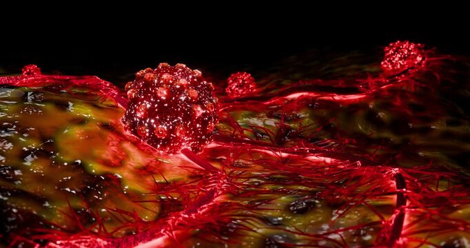 Cancer Microenvironment Showing Neovascularization Around Aggressive Tumor Cell During Angiogenesis and Progressive Tissue Invasion 3D Rendering
