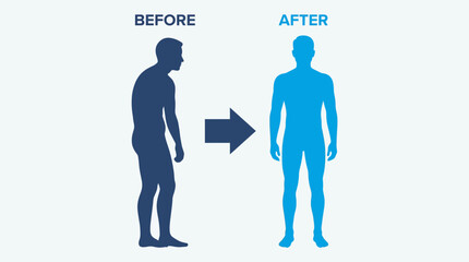 Posture Correction Before After Silhouette Comparison © Bima