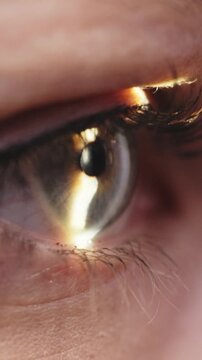 Close-up view of a human eye during biomicroscopy, showcasing pupil dilation and reflection of light, with detailed eyelashes and iris structure visible