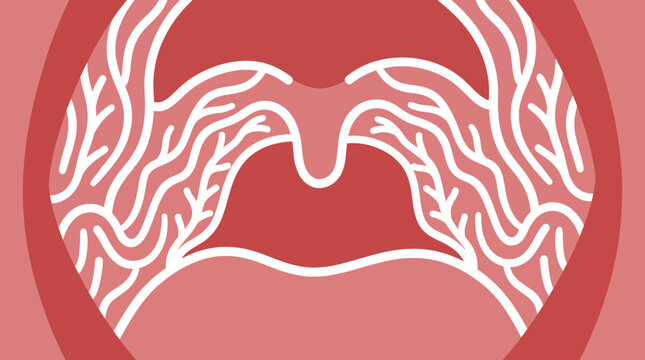 Oral Lichen Planus White Striae Pattern