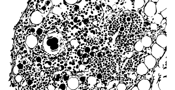 Microscopic view of sponge-like biological tissue structure