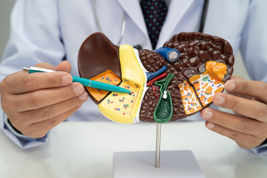Liver with gallbladder, pancreas spleen and duodenum, Asian doctor holding human anatomy model for study diagnosis and treatment in hospital.