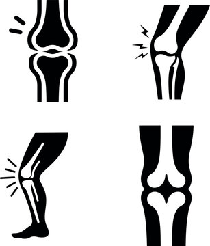 Medical illustration of knee joint injuries and healthy knee anatomy