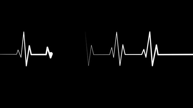 Electrocardiogram line heartbeat rhythm and medical monitor trace animation