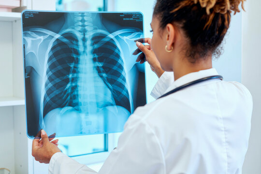 Black female doctor examining chest X ray film in clinic, assessing lung health and diagnostic results. Ideal for healthcare, radiology, respiratory care, medical screening