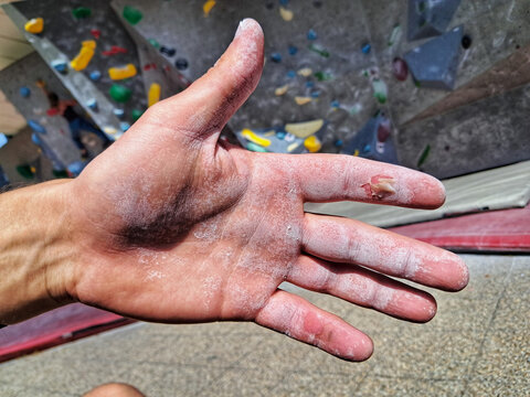 A close up of a climber open hand covered in white chalk showing a small skin injury on a finger with a bouldering wall behind.