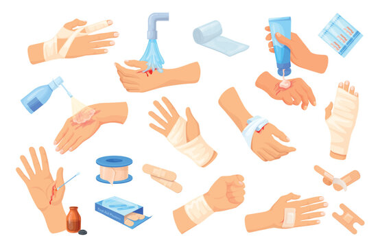 Injured hand first aid. Hands skin wound burn cut injury, bandage plaster dressing emergency care hospital treatment broken bleeding blood finger wrists neat vector illustration