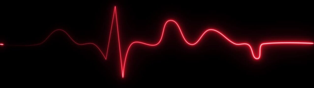Red electrocardiogram waveform on black background representing a heart rhythm display