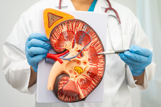 Chronic kidney disease, doctor with model for treatment urinary system, urology, Estimated glomerular filtration rate eGFR.